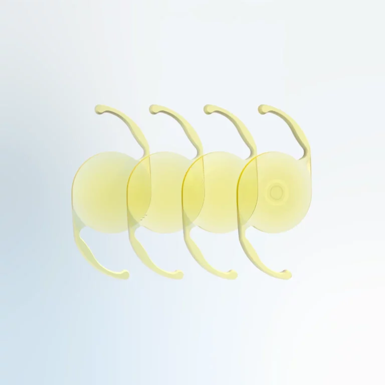 Multifocal IOL for cataract surgery